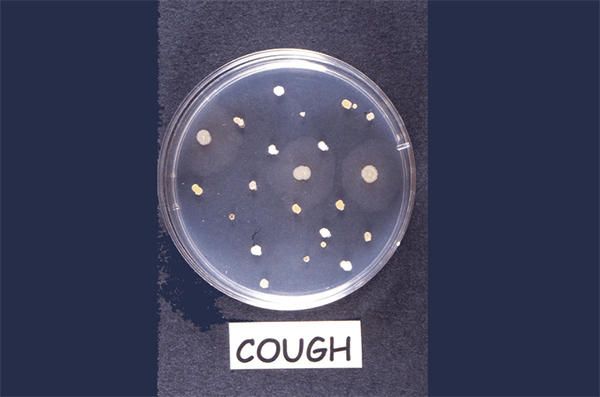 a petri dish with bacterial colonies growing on a beeswax substrate