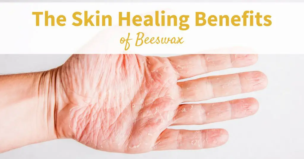 beeswax has healing qualities that can treat minor cuts, scrapes, burns and skin irritation