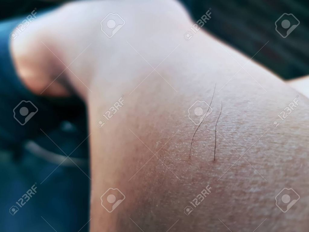close up photo of a woman's leg with regrown hair after waxing.